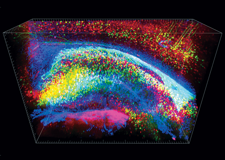 Deep Learning for Neuroimaging of Disease